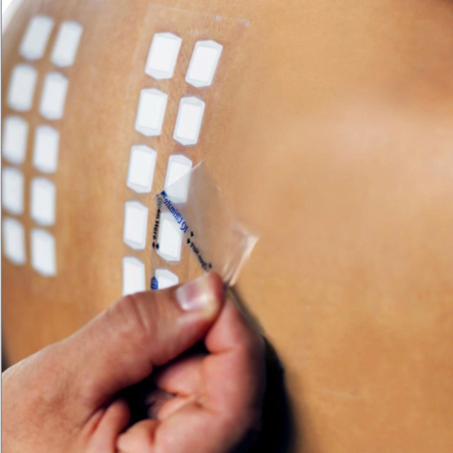 XÉT NGHIỆM DỊ ỨNG